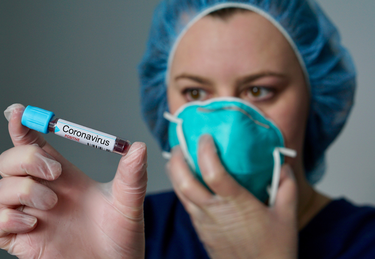 Važno!!! Odluka – koronavirus (COVID-19)